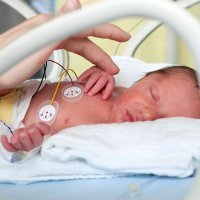 Diferentes tipos de bebés prematuros