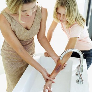 Heridas por quemaduras en la piel del niño