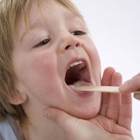 Qué es la gingivoestomatitis. Inflamación en la boca de bebés y niños