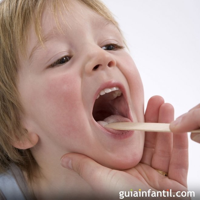 Al borde Oír de Similar Qué es la gingivoestomatitis. Inflamación en la boca de bebés y niños