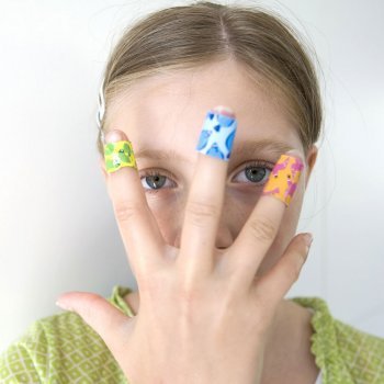 Las verrugas en los niños. Causas y tratamiento