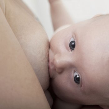 Callos o ampollas de succión en el bebé lactante