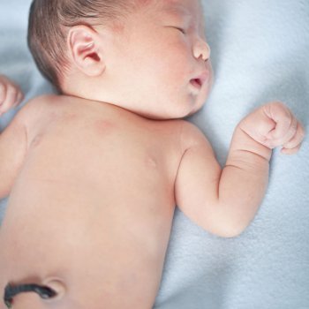 Los problemas del ombligo del recién nacido