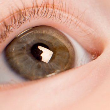 Astigmatismo en bebés y niños. ¿Qué es?