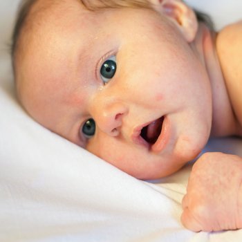 Causas de los granitos en la cara del bebé