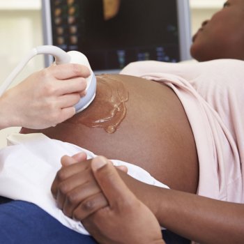 Causas de muerte fetal en el embarazo