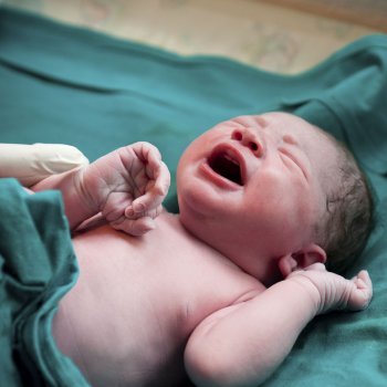 Estrechamiento de colon en los recién nacidos