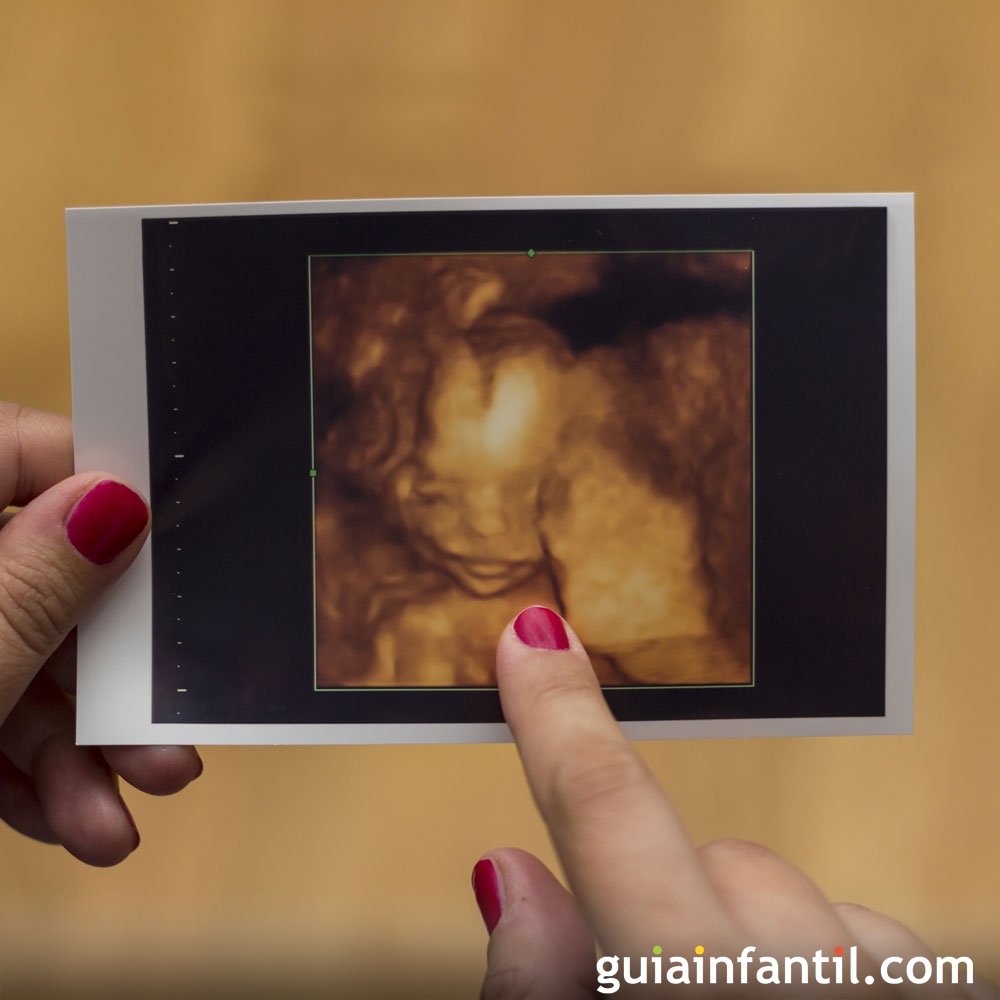 escaneo de citas de ocho semanas de embarazo