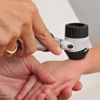 Síntomas del cáncer infantil en los niños y bebés