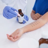 Alergia. Niños alérgicos Alergia. Niños alérgicos