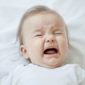 Síndrome de Apert. Enfermedades infantiles