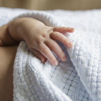 Cianosis. Piel azulada del bebé