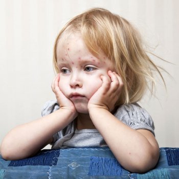 Niños y bebés con rubéola