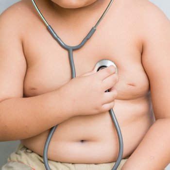 Obesidad infantil, un problema de peso