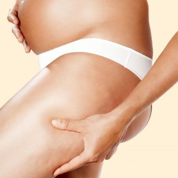 Alimentos para reducir la celulitis