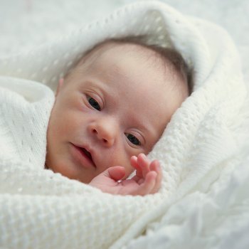 Lactancia materna en bebés con Síndrome de Down