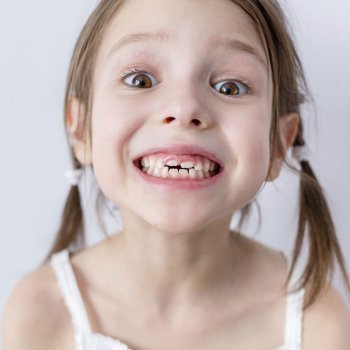 Por qué hay dientes de leche que no se caen en la infancia