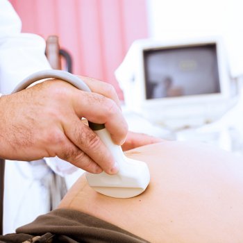 Síndrome del gemelo evanescente