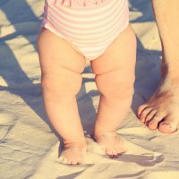 Niños con las piernas arqueadas