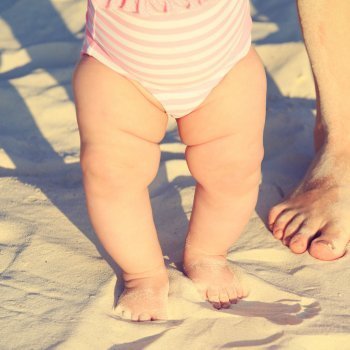 Niños con las piernas arqueadas