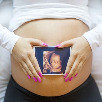 Lo que debes saber del tamizaje genético