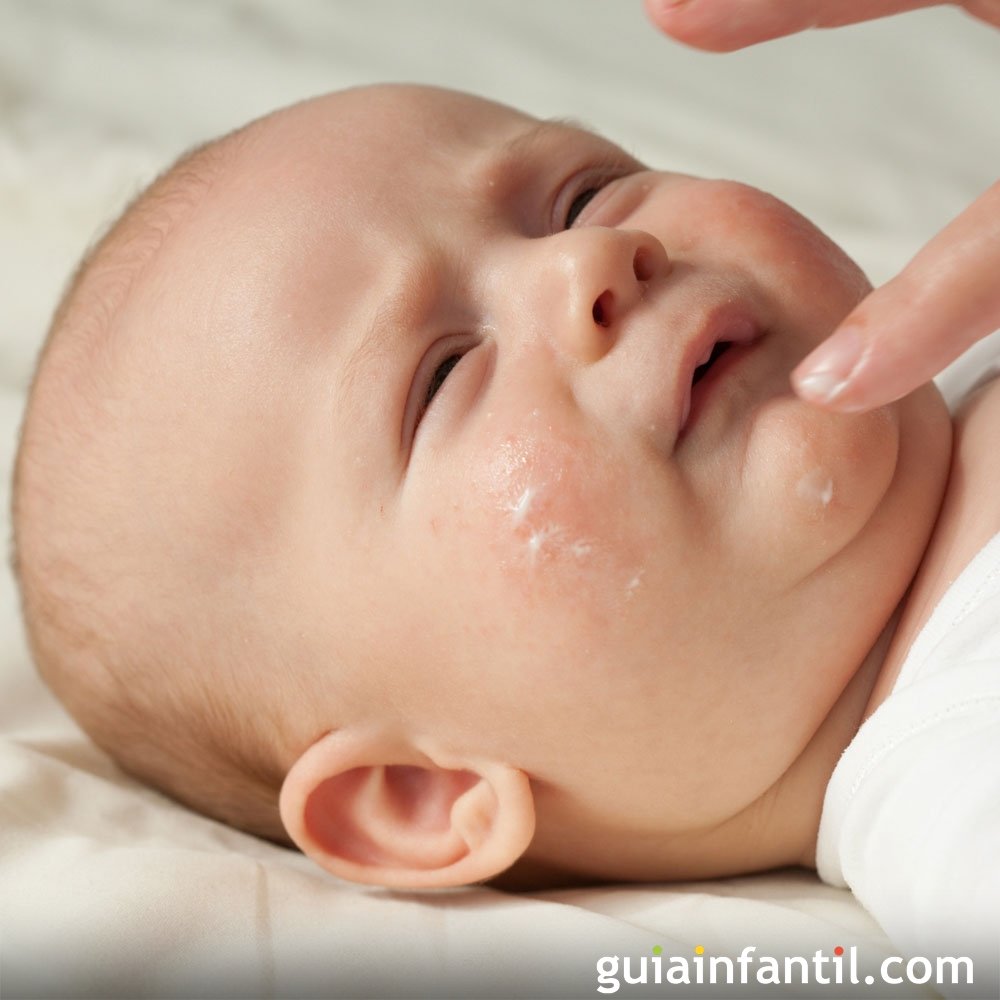 Jabón para bebés alérgicos