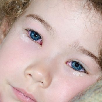 Los peligros de los punteros láser para los niños