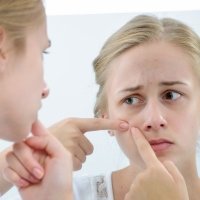 Alimentación y acné en adolescentes