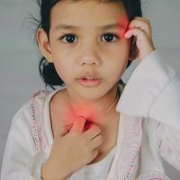 Síntomas para detectar si tu hijo tiene escarlatina