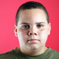 Problema de la obesidad en la adolescencia