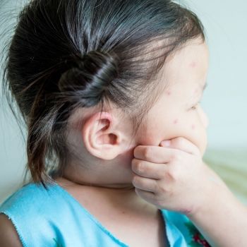 Claves para evitar picaduras de mosquitos en niños y embarazadas