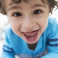 La decisión de cortar o no el frenillo lingual a los niños