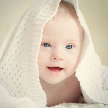 Beneficios de la leche materna para bebés con Síndrome de Down