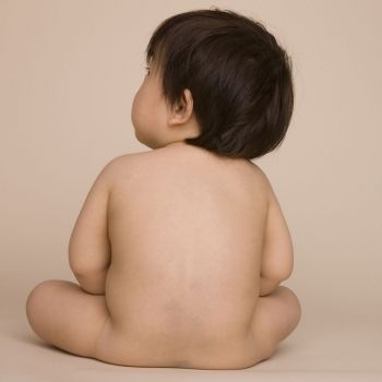 Preguntas y respuestas sobre la mancha mongólica del bebé