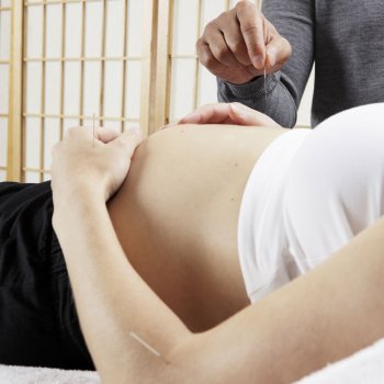 La acupuntura para embarazadas que sufren de nauseas y vómitos