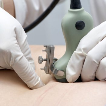 La prueba de la amniocentesis da positivo: ¿y ahora?