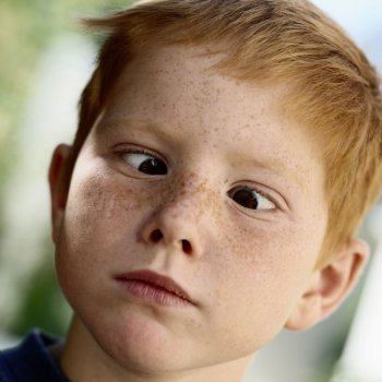 La discriminación hacia los niños bizcos en los cumpleaños