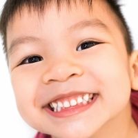 El estrés: principal responsable del bruxismo dental en los niños