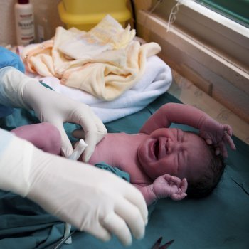 Cuándo se debe cortar el cordón umbilical del bebé