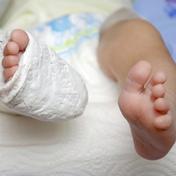 Las fracturas que pueden ser señales de abuso infantil