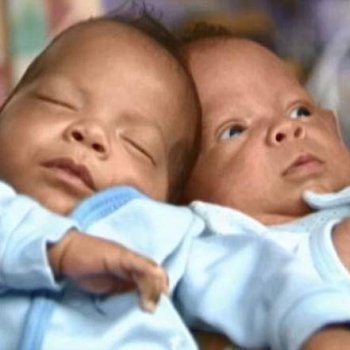 Los gemelos que nacieron con 24 días de diferencia