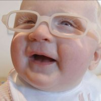 La primera vez que una bebé albino ve a su madre