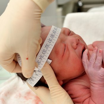 Microcefalia en bebés por virus Zika provoca alerta mundial