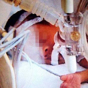 El bebé milagro que despertó llorando antes de ser incinerado