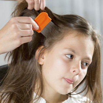 La pesadilla de los piojos para los padres