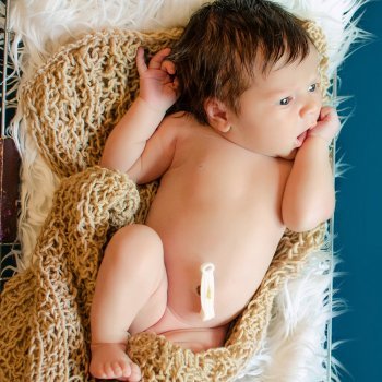 ¿Por qué nuestros ombligos son diferentes?