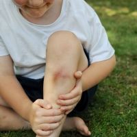 Qué hacer con los hematomas y moretones de los niños