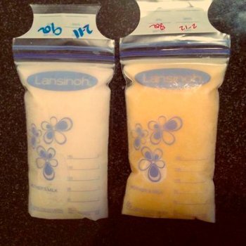 Increíble foto del poder de la leche materna para curar al bebé