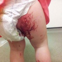 Lo que puede ocurrirle a tu hijo en un parque infantil