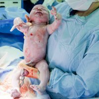 Riesgos de la siembra vaginal en el recién nacido